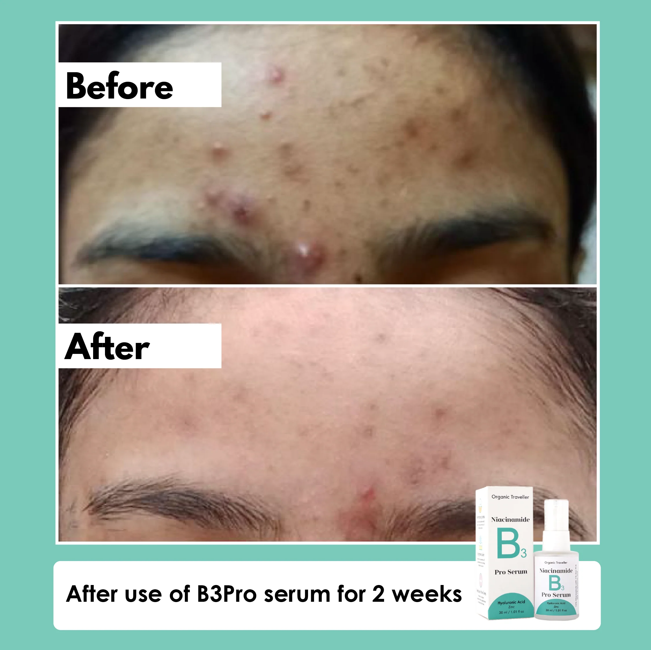 B3 PRO: Pore erasing serum - Image 3