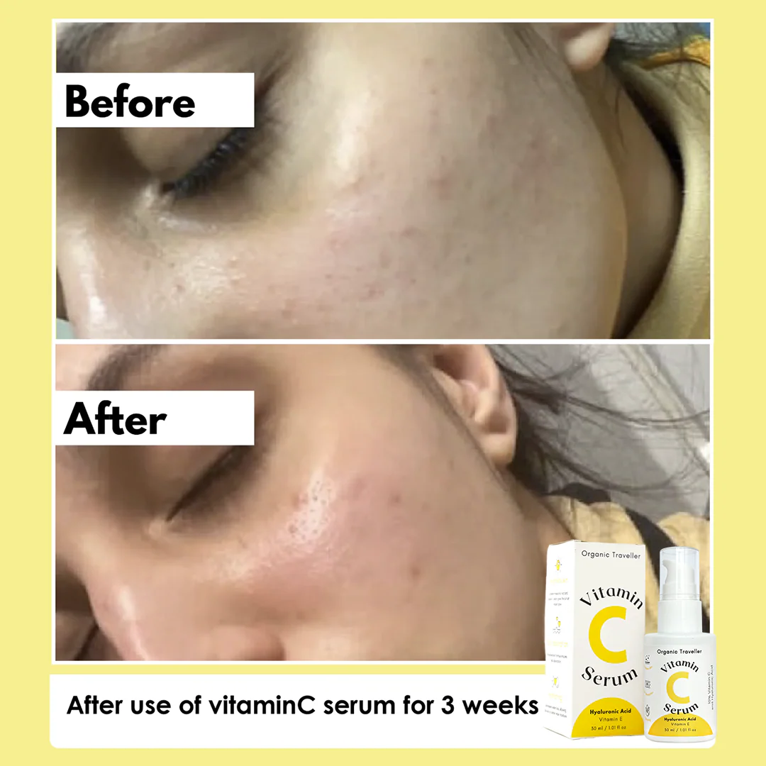 Super C: Vitamin C serum - Image 3